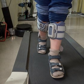 Die Beine einer Person, die sich auf einem Laufband fortbewegt.